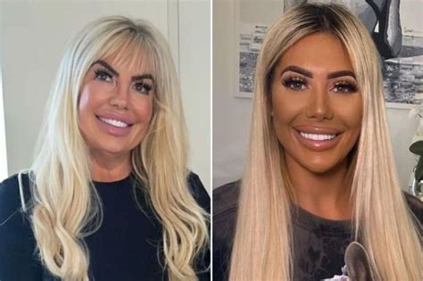 chloe ferry mum|chloe ferry before surgery.